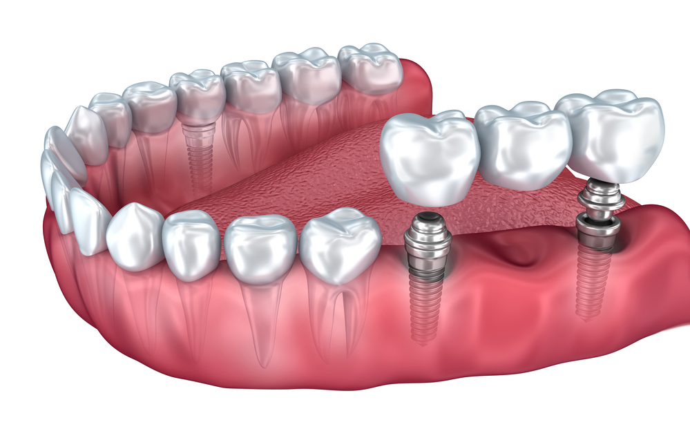 Perion Dental Health Center